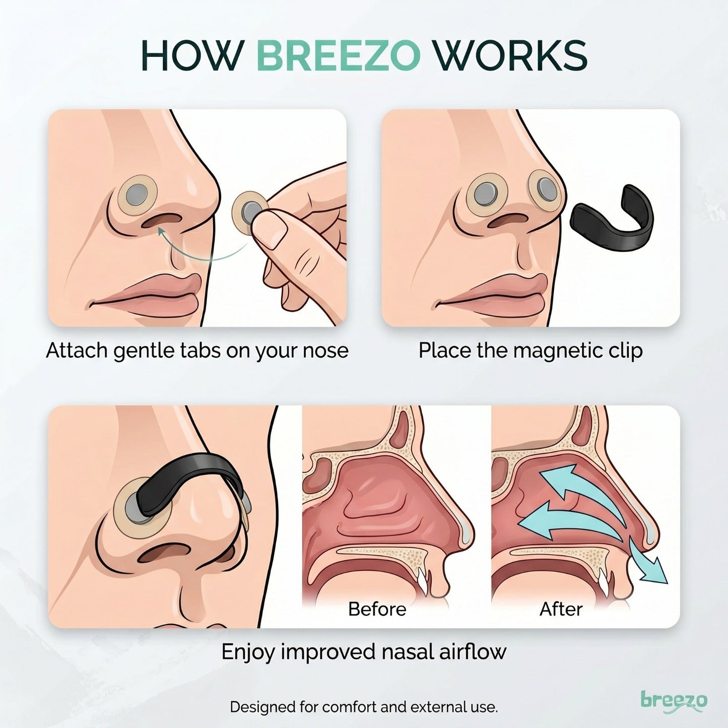 Magnetic Nasal Dilator - Anti Snoring Kit 4 Sizes